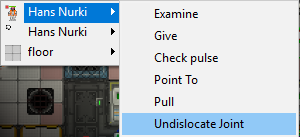 Joint2.png